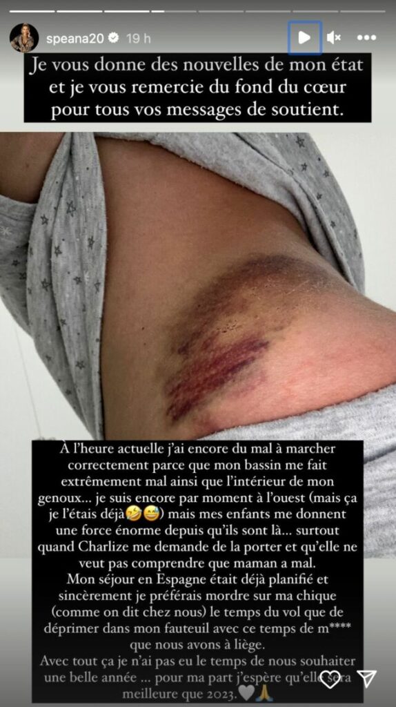 Stéphanie Clerbois a du “mal à marcher” après son accident de voiture